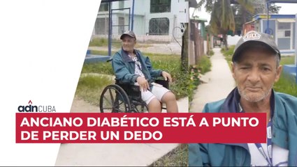 Anciano diabético está a punto de perder un dedo