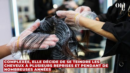 À 25 ans, elle décide d'assumer ses cheveux blancs alors que c'était son plus grand complexe