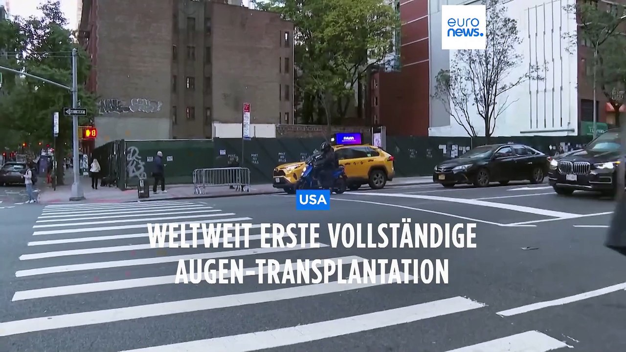 Weltweit erste vollständige Augen-Transplantation gelungen