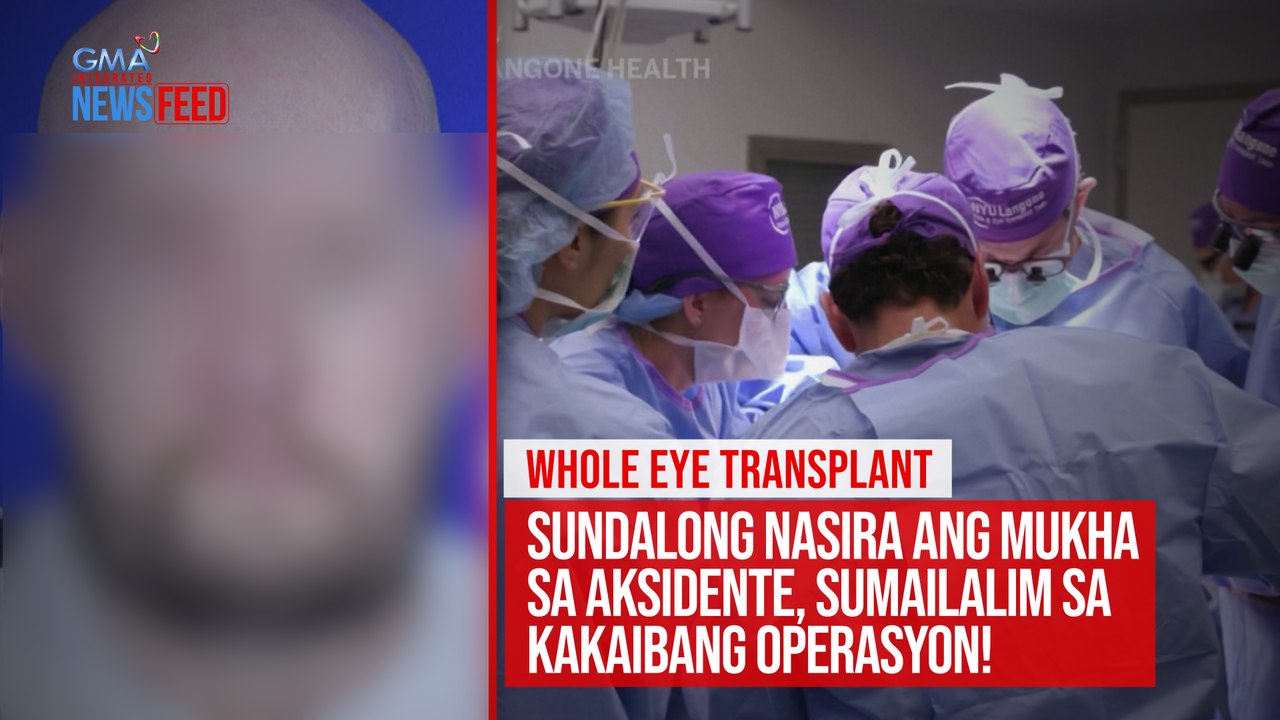 Sundalong nasira ang mukha sa aksidente, sumailalim sa kakaibang operasyon! | GMA Integrated Newsfeed