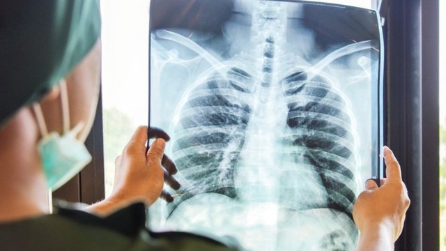 Prof. Dr. Tevfik Özlü: Zatürre birinci sırada