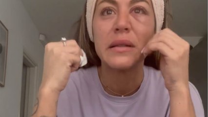 Anaïs Camizuli violemment frappée par un inconnu et "défigurée", elle sort du silence et s'explique