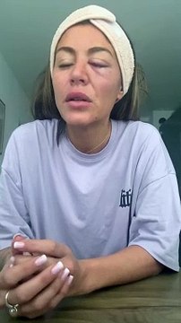 Anaïs Camizuli a été agresséeAnaïs Camizuli révèle avoir été frappée par un inconnu dans la rue le 12 novembre 2023.