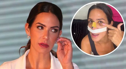 Tamara Gorro muestra la realidad de su cara tras la operación: "Tengo un sombreado permanente"