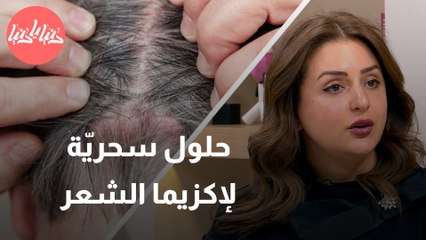 كيف تتغلّب على إكزيما الشعر؟ طبيبة جلديّة تُجيب