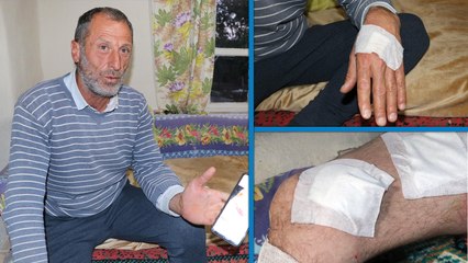 Ayının saldırdığı çoban zor kurtuldu: Köpekler olmasaydı öteki dünyaya gitmiştik