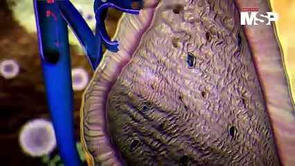 ¿Cuáles son los efectos de la adrenalina en el cuerpo? - #ExclusivoMSP