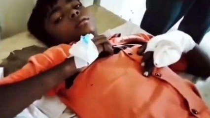 चूरू: पायली गांव में हादसा, 10 वर्षीय बालक के हाथ मे फटा पटाखा, देखिए क्या हुआ हश्र