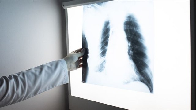 Prof. Dr. Tevfik Özlü’den ‘KOAH’ uyarısı