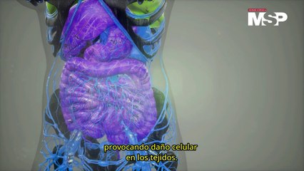 Cuando la extracción de muelas conduce a una falla multiorgánica