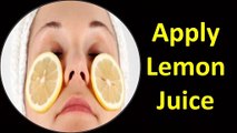 रातों रात मुहाँसे गायब  | How To Remove Pimples Overnight - Acne & Pimple Treatment _ UMBJ _