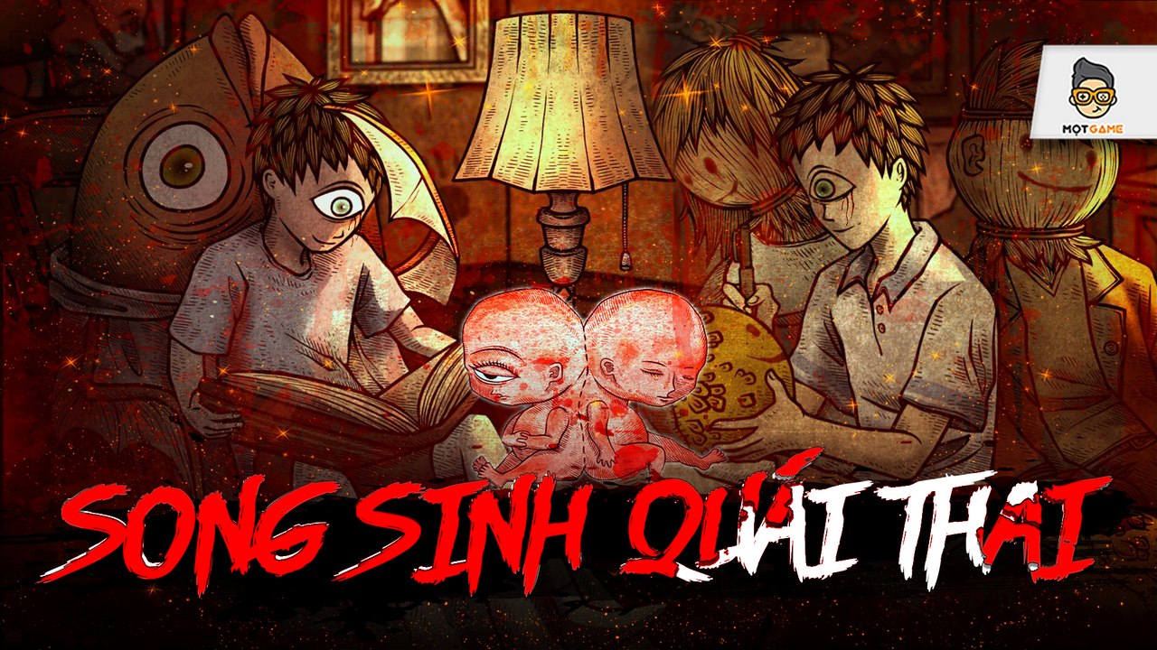 Life Gallery: Cặp song sinh dính liền quái dị