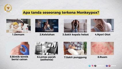 Waspadai Gejala dan Cara Penularan Virus Monkeypox