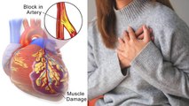 Winter में ज्यादा Heart Attack क्यों आता है | Heart attack Symptoms Treatment In Hindi | Boldsky