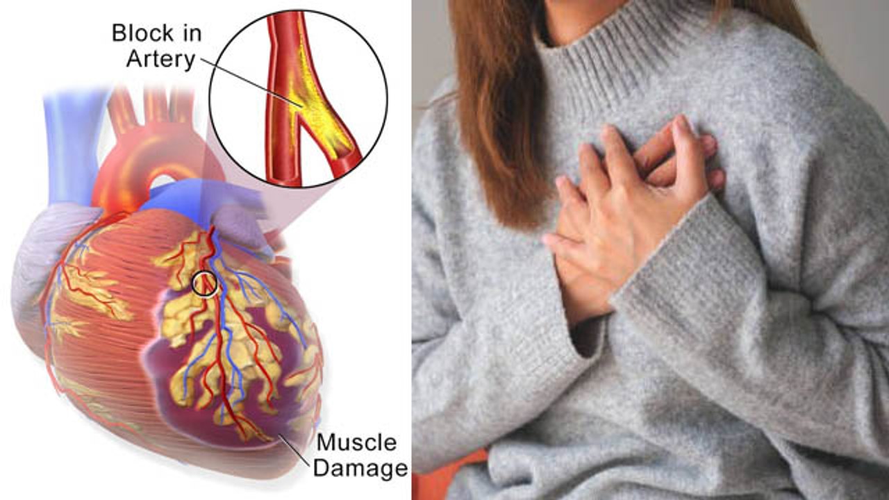 Winter में ज्यादा Heart Attack क्यों आता है | Heart attack Symptoms Treatment In Hindi | Boldsky