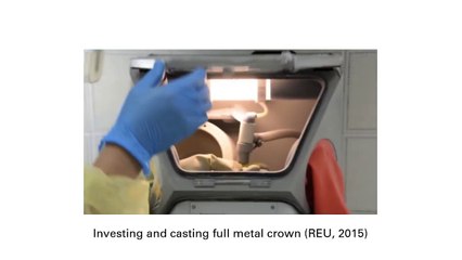 الخلائط المعدنية في طب الأسنان _ يمان اليوسف