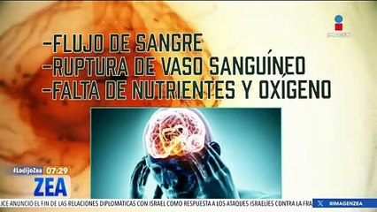 Accidentes cerebrovasculares: lo que sebes saber