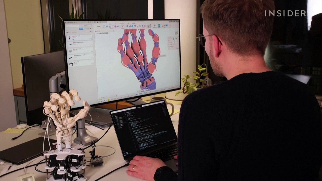 This robotic hand could be the future of prosth...