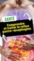 Reflux gastro-œsophagien : Ce qui le cause et comment le traiter ?