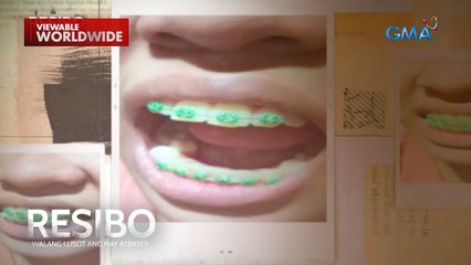 Babae, mas lumala ang problema sa ngipin dahil umano sa pekeng dentista! | Resibo