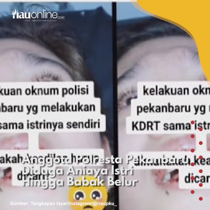 Anggota Polresta Pekanbaru Diduga Aniaya Istri Hingga Babak Belur