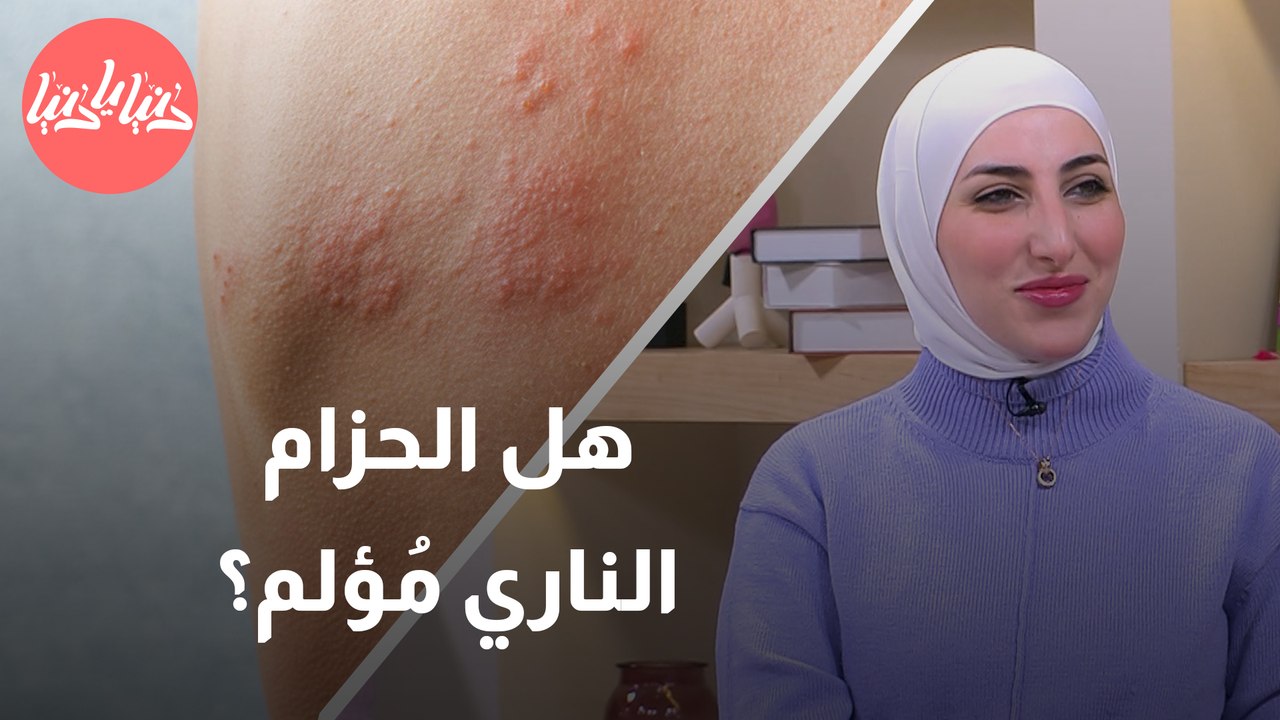 ما أسباب الإصابة بالحزام الناري؟ وهل يمكن الإصابة به أكثر من مرة؟
