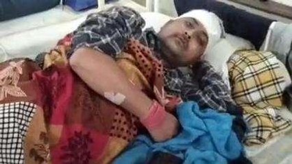 शिवपुरी: दो भाईयों के साथ जमकर हुई मारपीट, जिला अस्पताल में भर्ती