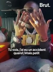 Doigt coupé de Sidiki Diabaté : Découvrez les révélations intimes du chanteur (VIDEO)