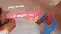 ¿Cuándo y cómo se diagnostica la dermatitis? - #ExclusivoMSP