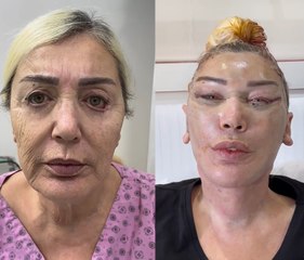 Seda Sayan'ın ablası estetik operasyonu geçirdi... Değişimi şaşırttı!