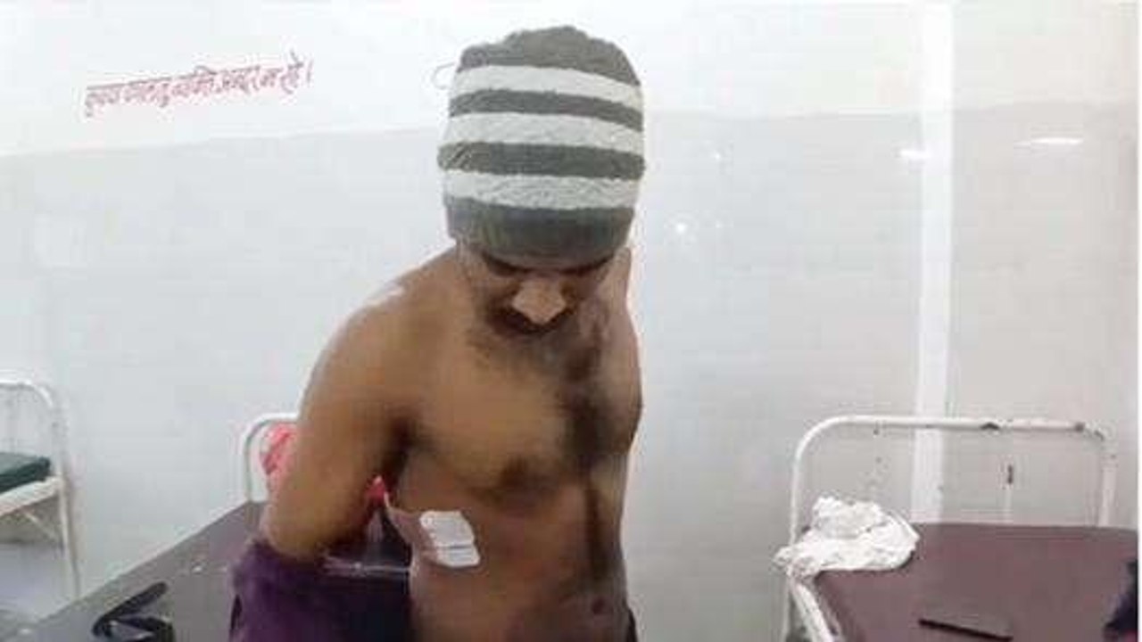 खरगौन: लूट के इरादे से युवकों ने बाइक सवार पर चाकू से किया हमला,देखें video