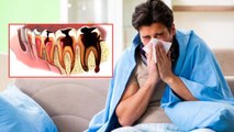 Cold Cough से Teeth Pain क्यों, Dry Mouth से लेकर Cavity का खतरा कैसे | Boldsky