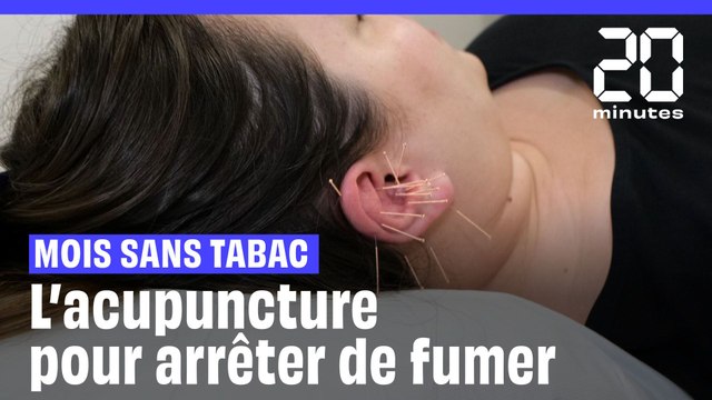Mois sans tabac : Et si vous essayiez l'acupuncture (dans l'oreille) pour arrêter de fumer ?