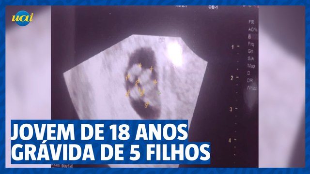 Estudante de 18 anos passa mal ao descobrir que está grávida de 5 bebês