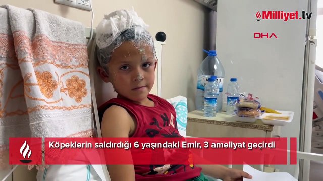 Sokak köpekleri 6 yaşındaki Emir'e dehşeti yaşattı!