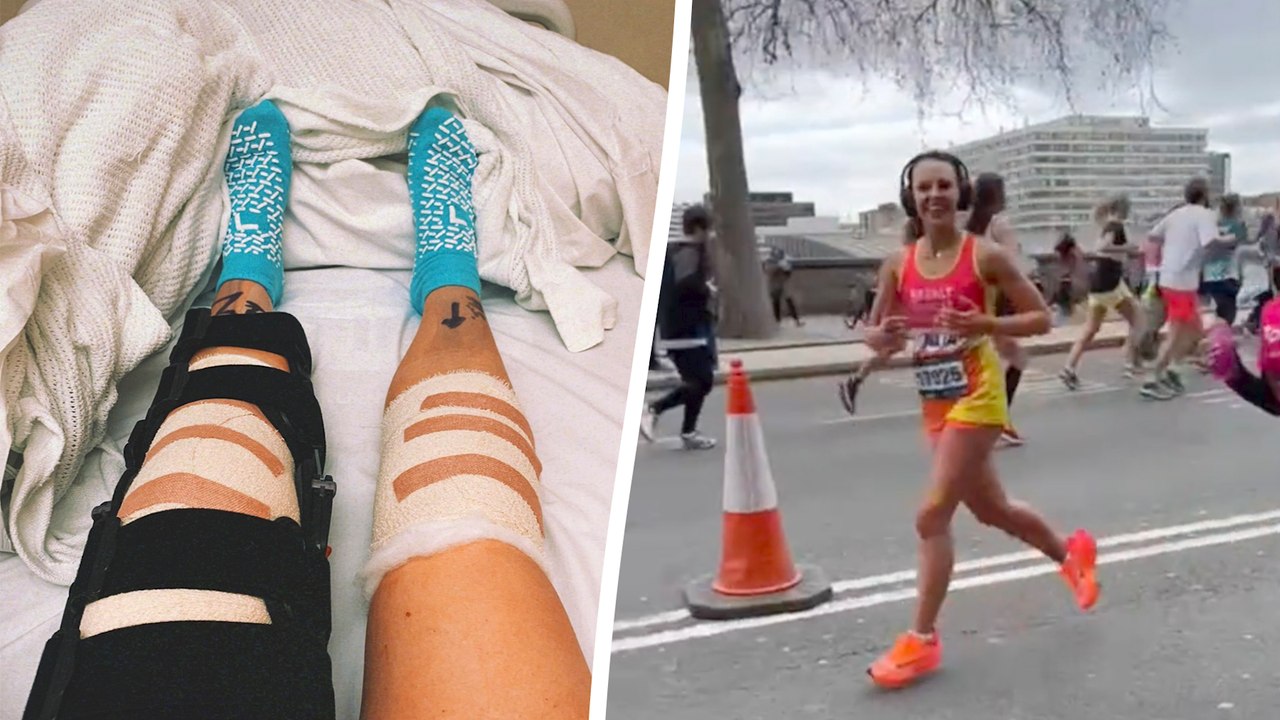 “I Was in a Horror E-Scooter Crash - I Had To Learn To Walk Again Aged 25”