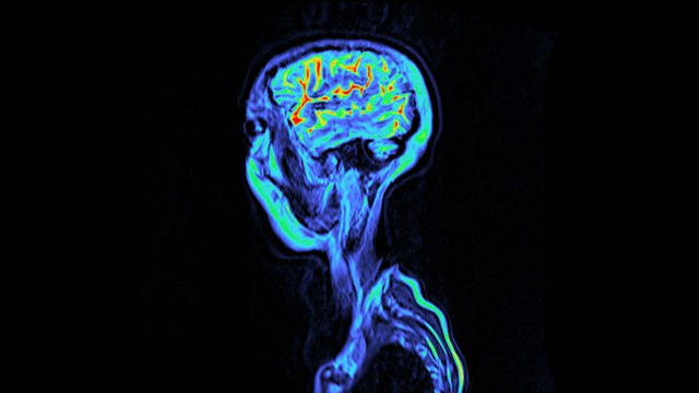 Studie enthüllt: Das hat dein Darm mit deiner geistigen Gesundheit zu tun