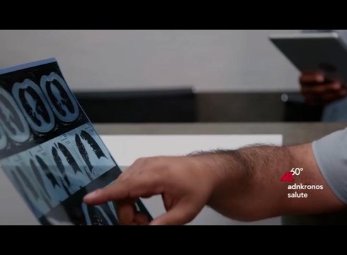Salute: “Nuove opzioni. Nuovi percorsi” contro il tumore al polmone