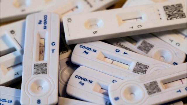 Covid-19 : l’épidémie repart, notre carte de France par département