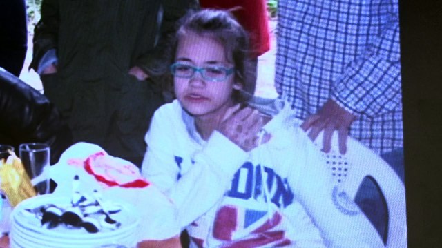 Bullying y falta de autoestima son los principales retos de personas con dermatitis atópica grave