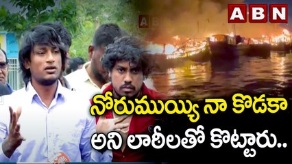 నోరుముయ్యి నా కొడకా అని లాఠీలతో కొట్టారు... || LOCAL BOY NANI || VIZAG || ABN TELUGU