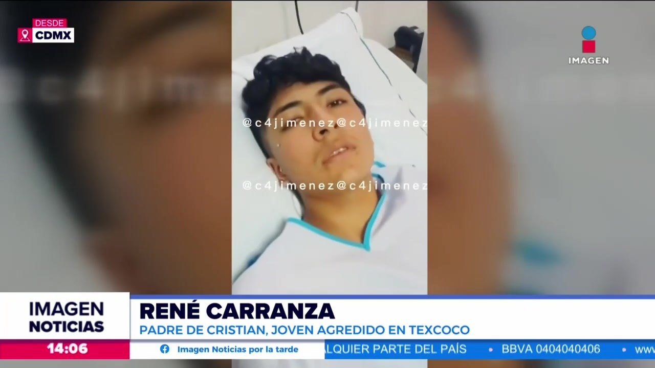 Cristian fue operado tras sufrir agresión por parte de sus compañeros