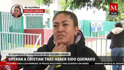 ¿Cuál es el estado de salud de Cristian, joven quemado en Edomex?