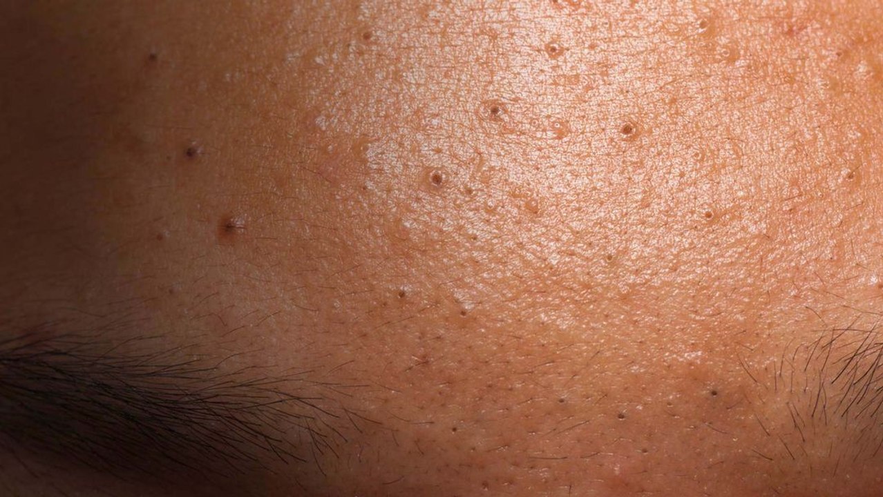 What Happens If You Don't Shower for a Month?