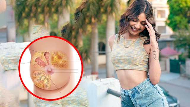 Young Females में Breast Cancer का खतरा क्यों बढ़ रहा है| Cancer Reason And Symptoms In Hindi|Boldsky