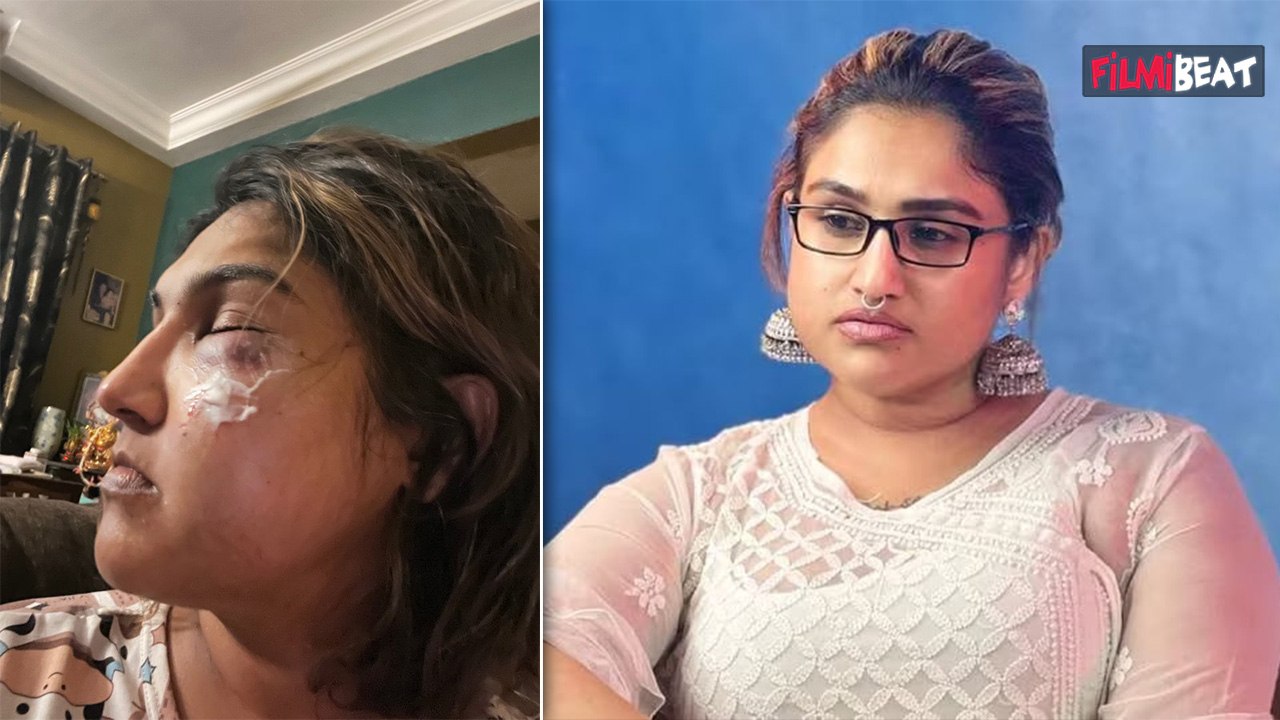 Bigg Boss Tamil ex Contestant Vanitha Vijayakumar पर हुआ हमला, सूजी आंख-चेहरे पर चोट, बिगड़ा चेहरा