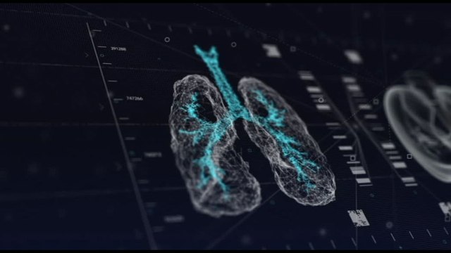 Tumore al polmone, via a campagna Nuove Opzioni. Nuovi Percorsi