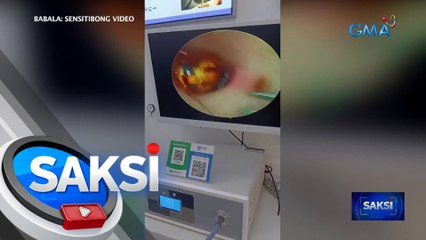 Ipis, natagpuan sa loob ng tainga ng lalaki | Saksi
