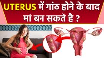 Uterus Fibroid Pregnancy Chances Reveal: बच्चेदानी में गांठ होने के बाद प्रेगनेंट हो सकते है