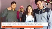 Nació con los órganos ubicados al revés qué es situs inversus